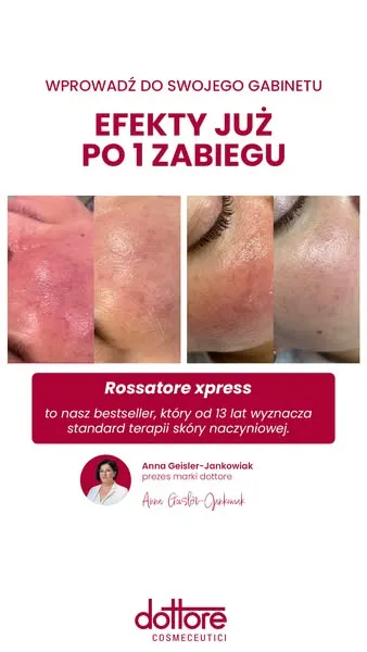 An ad for the Rossatore Xpress treatment for salons